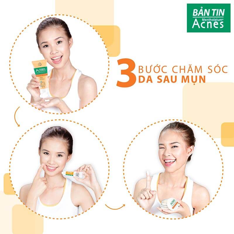 3 buoc cham soc lan da nhay cam sau mun voi acnes vitamin cleanser, acnes scar care, acnes vitamin cream