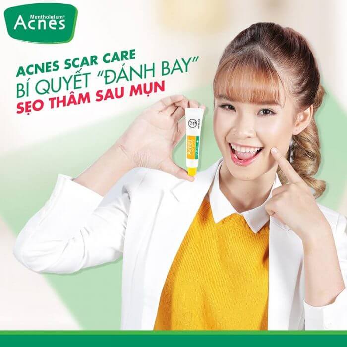 Acnes Scar Care, nói lời tạm biệt với vết tham mụn đáng ghét