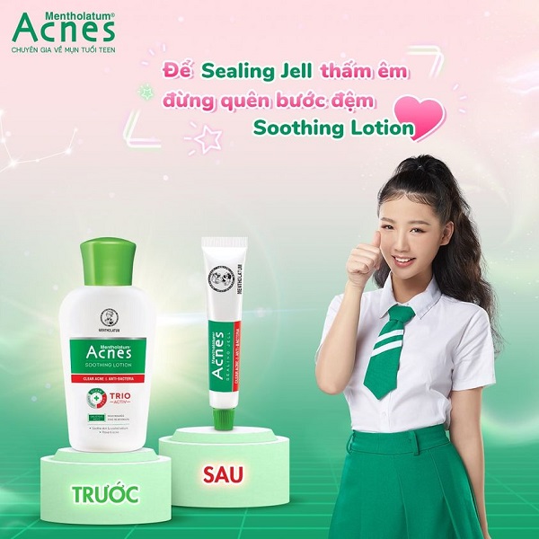 Acnes Soothing Lotion – Dung dịch dịu da kháng khuẩn