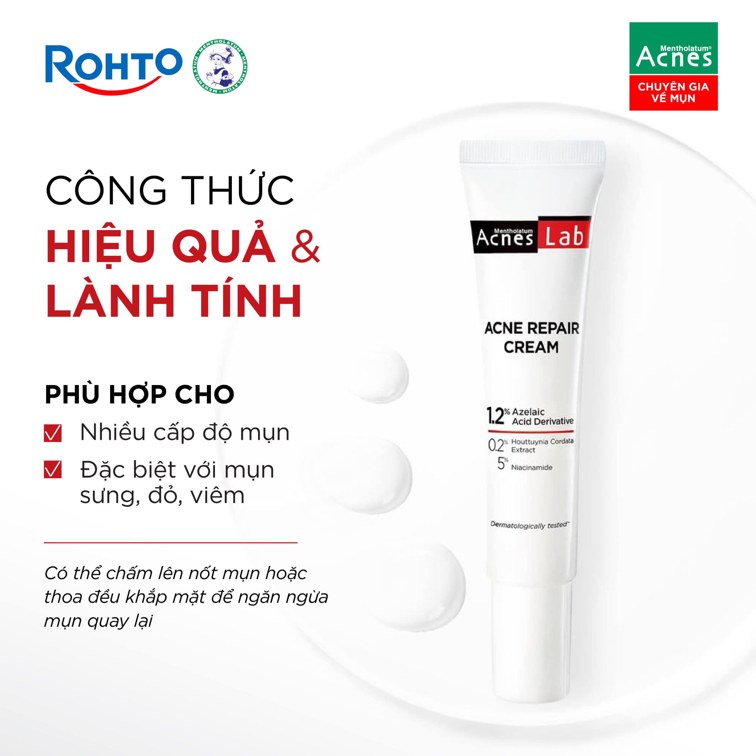 Acnes Lab Acne Repair Cream 20g - Ảnh 6