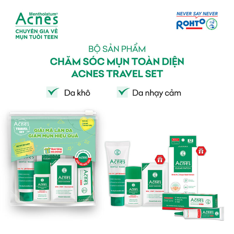 Acnes – Kem Trị Mụn Và Ngăn Ngừa Mụn