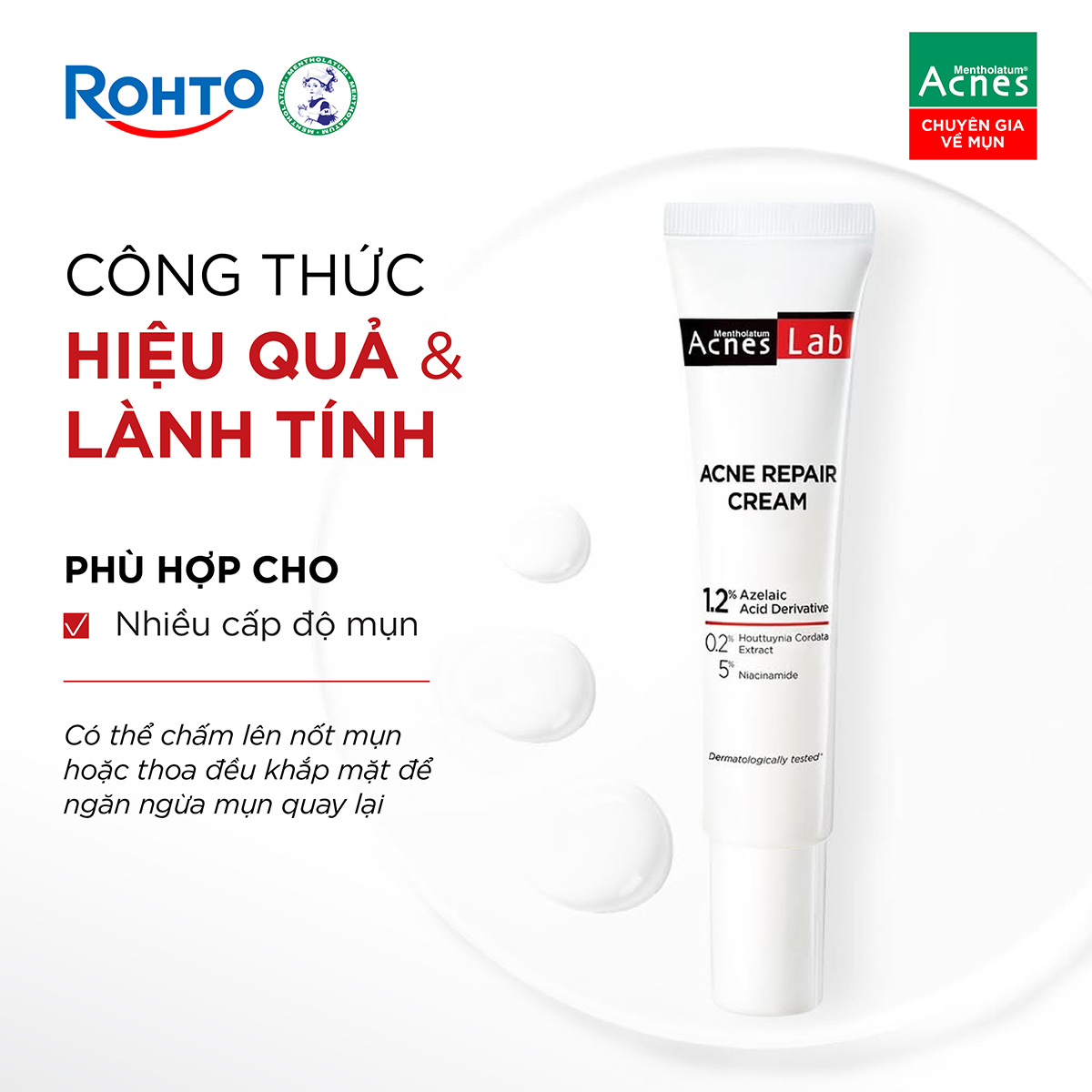 Mentholatum Acnes Lab Acne Repair Cream - Ảnh 5
