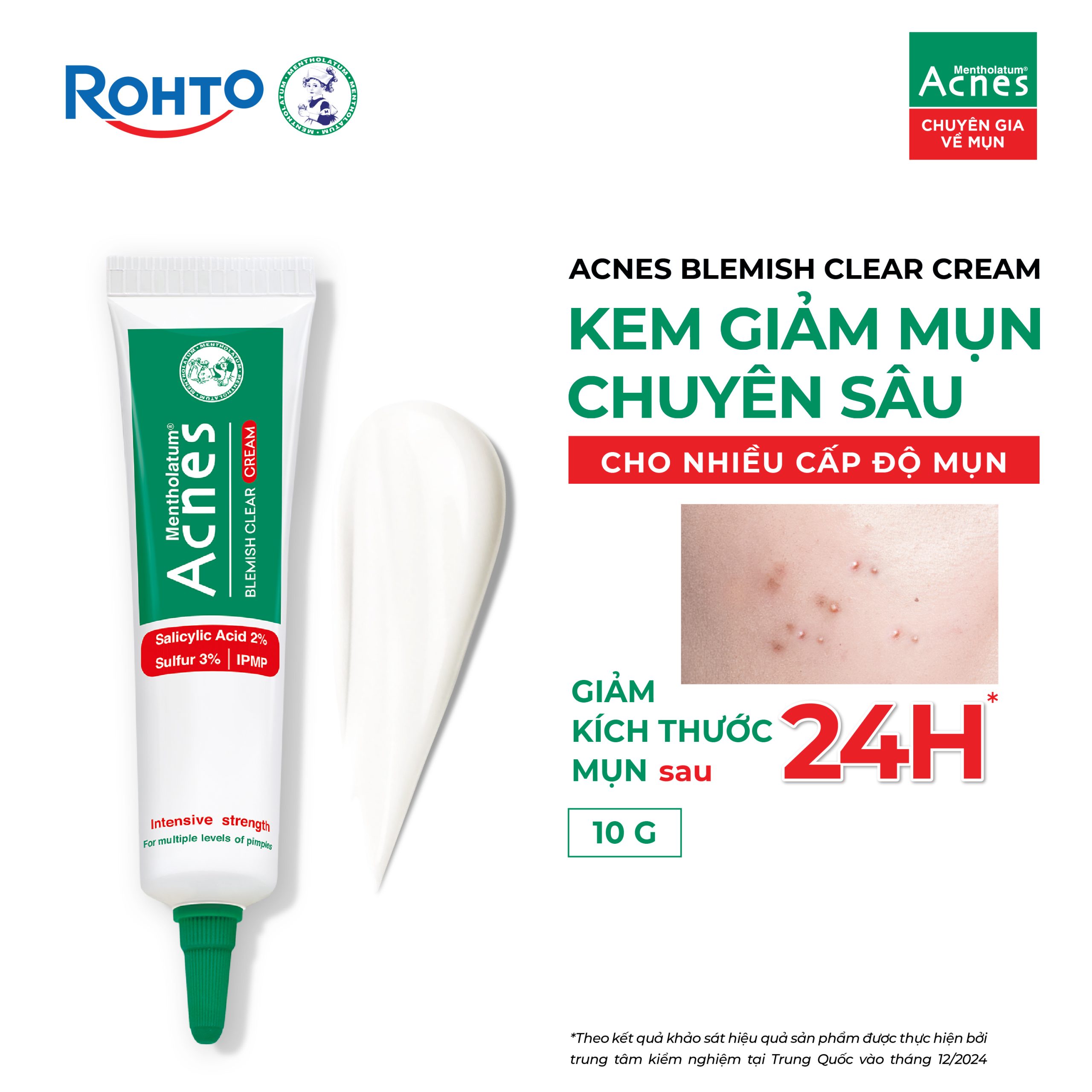 Mentholatum Acnes Blemish Clear Cream - Ảnh 3