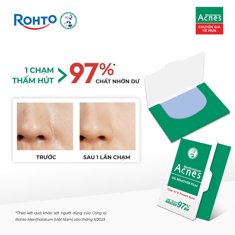 Acnes – Kem Trị Mụn Và Ngăn Ngừa Mụn