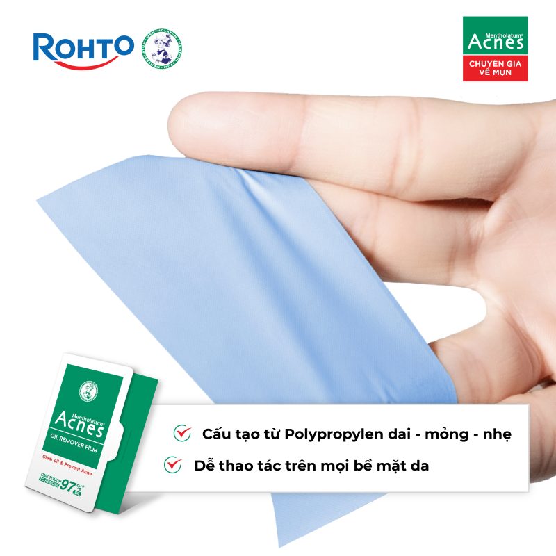 Acnes – Kem Trị Mụn Và Ngăn Ngừa Mụn