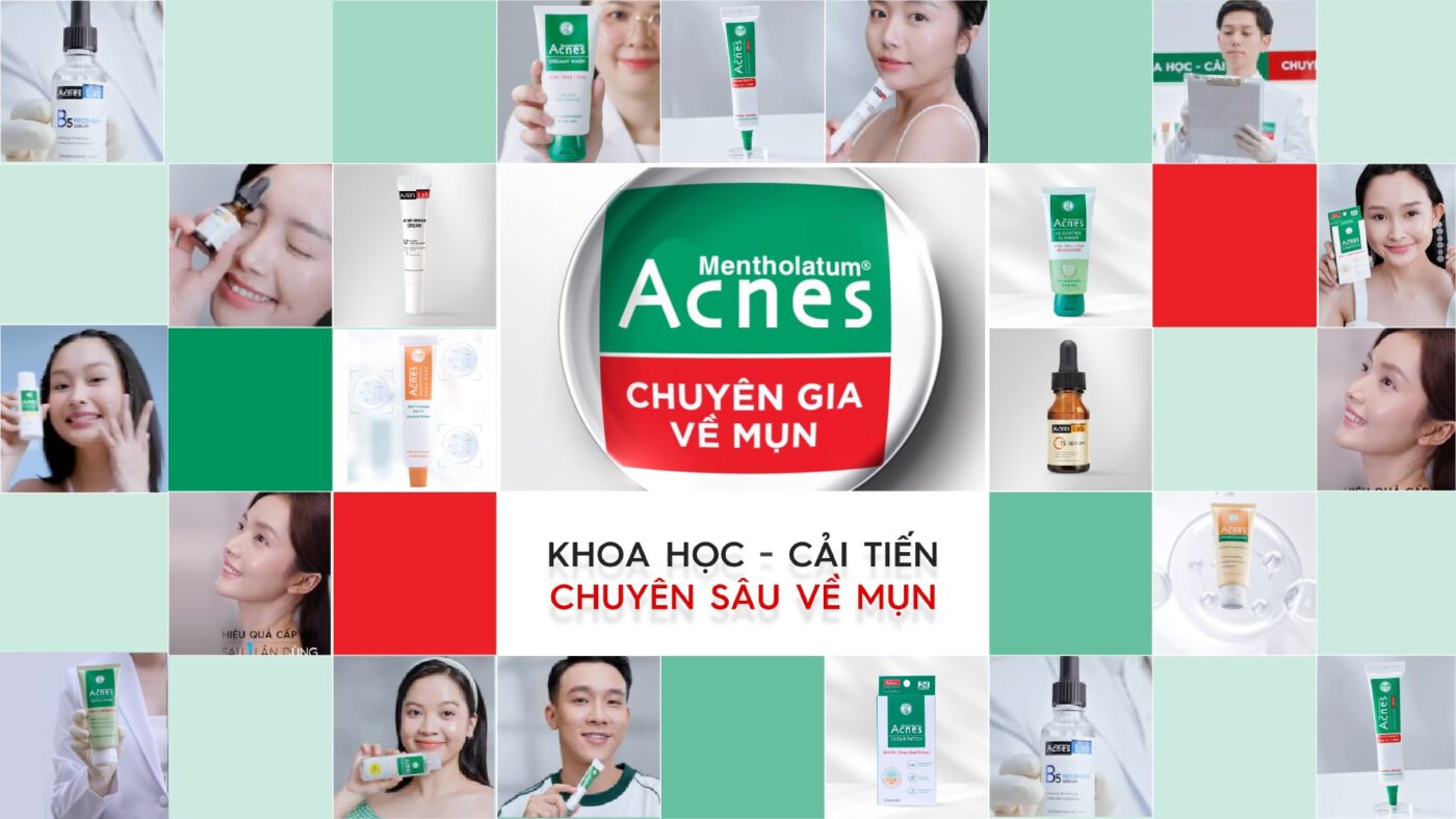 Acnes – Kem Trị Mụn Và Ngăn Ngừa Mụn