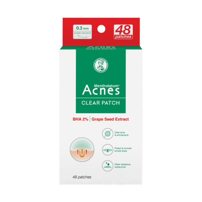 Acnes – Kem Trị Mụn Và Ngăn Ngừa Mụn