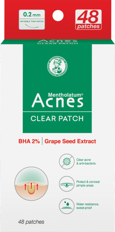 Acnes – Kem Trị Mụn Và Ngăn Ngừa Mụn