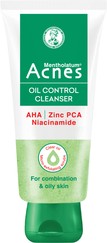 Acnes – Kem Trị Mụn Và Ngăn Ngừa Mụn