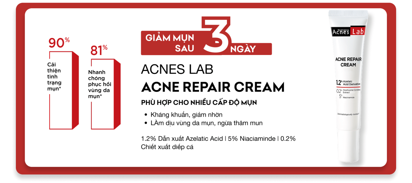 Acnes – Kem Trị Mụn Và Ngăn Ngừa Mụn