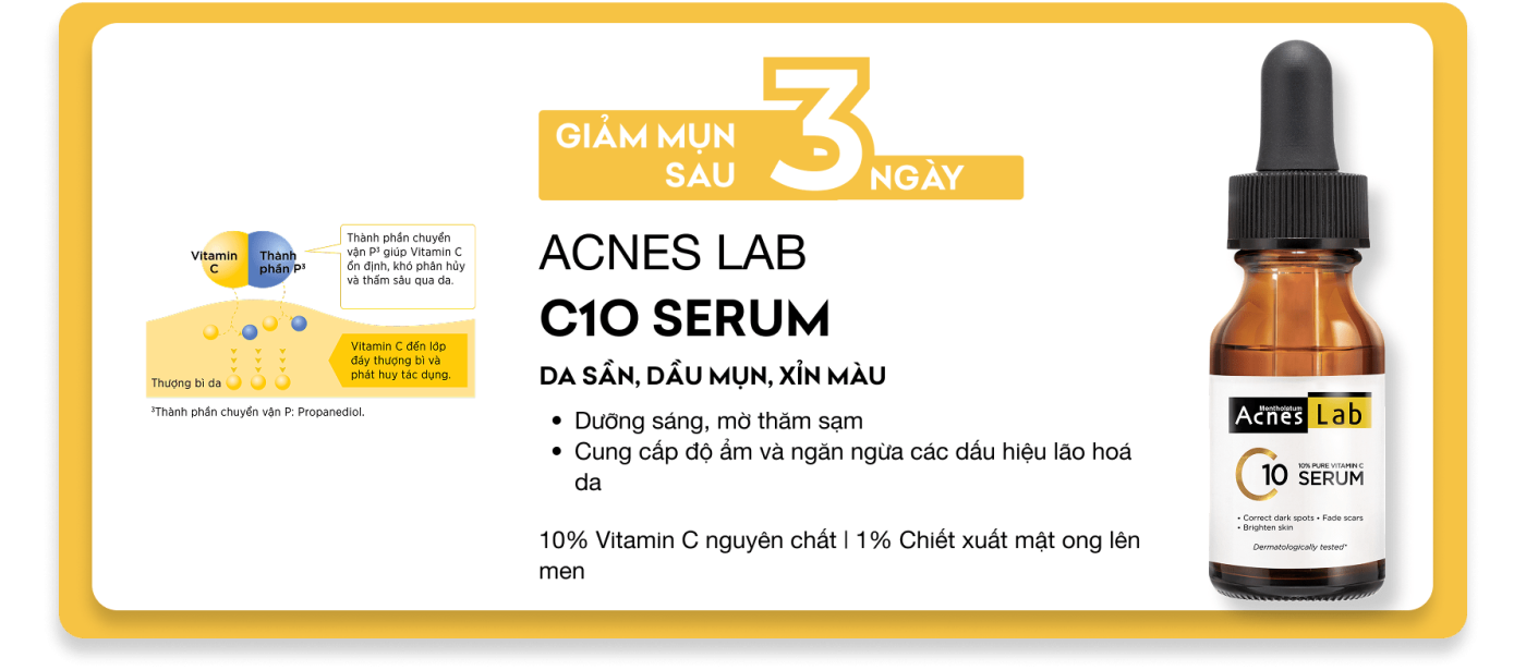 Acnes – Kem Trị Mụn Và Ngăn Ngừa Mụn