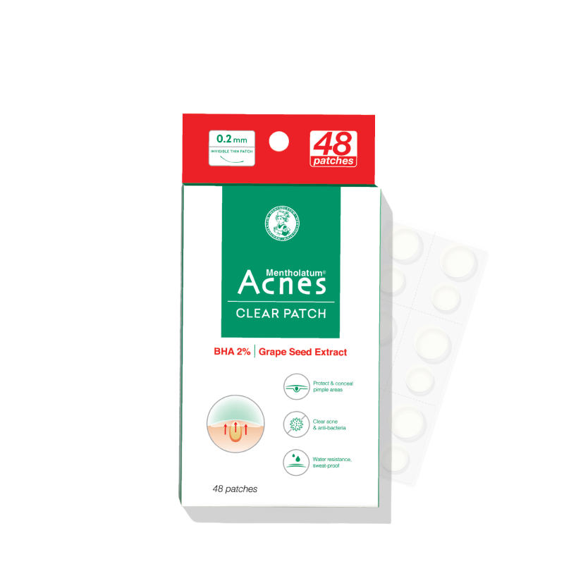 Acnes – Kem Trị Mụn Và Ngăn Ngừa Mụn