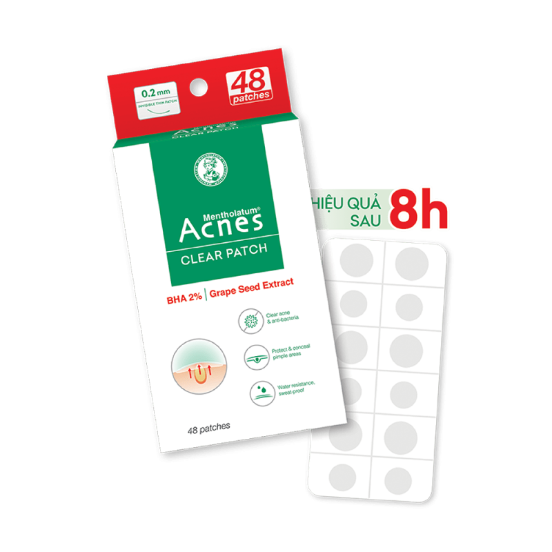 Acnes – Kem Trị Mụn Và Ngăn Ngừa Mụn