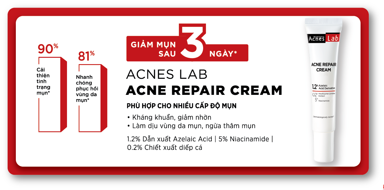 Acnes – Kem Trị Mụn Và Ngăn Ngừa Mụn